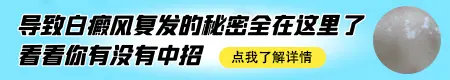 阳了以后白癜风复发了