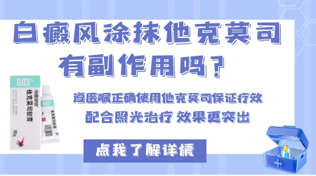 治白癜风为什么晚上摸他克莫司