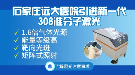 石家庄治疗白癜风 308激光照白斑效果最好吗