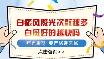 308激光照的次数越多白癜风恢复越快吗