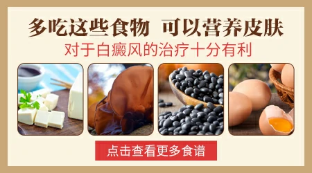 哺乳期患上白癜风对孩子有没有影响