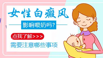 哺乳期患上白癜风对孩子有没有影响