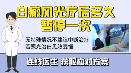 白癜风光疗间隔时间长影响效果吗