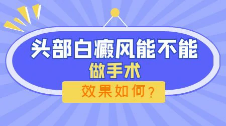 额头白癜风可以植皮吗