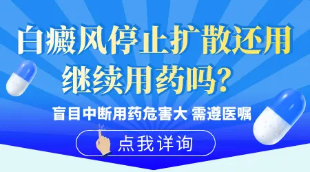 白癜风复色后还用他克莫司吗