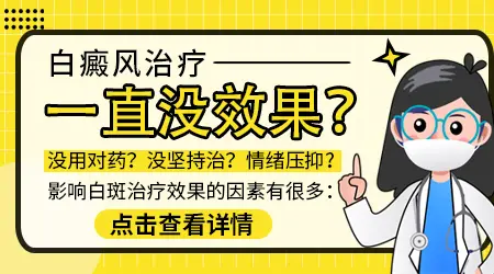 白癜风治疗一年了效果一般怎么回事