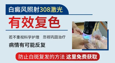 白癜风做308的恢复过程图