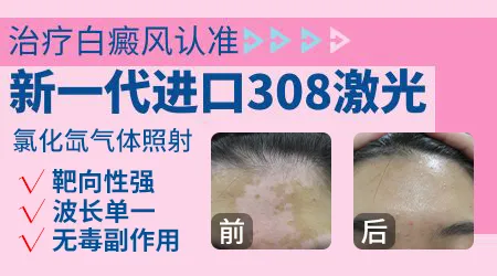 头部白斑照完308以后特别红特别痒