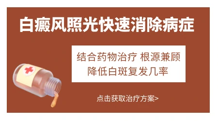白癜风自己在家买308仪器有用吗