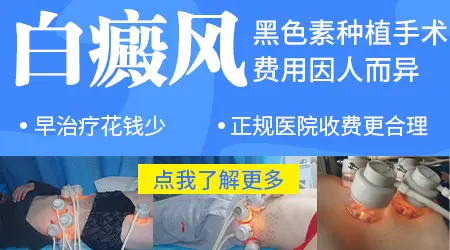 面部白癜风植皮手术后皮肤图