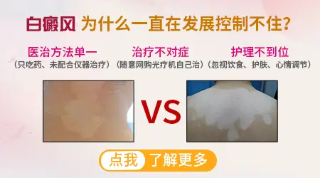 割耳朵放血能消灭白斑吗