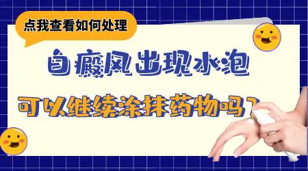 白癜风起水泡还可以继续抹药吗