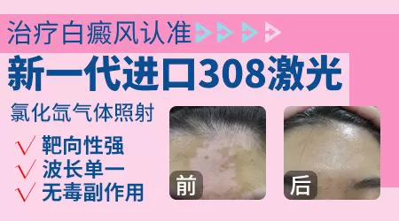 网上卖的308光疗仪靠谱吗