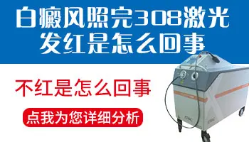 白癜风照308一直都不红是怎么回事
