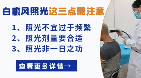 白癜风照308一直都不红是怎么回事