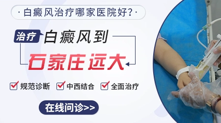 患上白癜风怎么培植新的黑色素