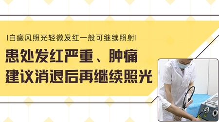 白癜风照308光红了之后还要继续照吗