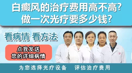 白癜风光疗一次多少钱
