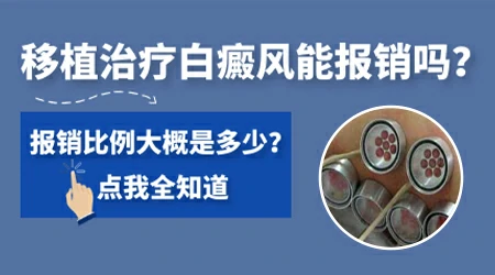 白癜风植皮要花多少钱