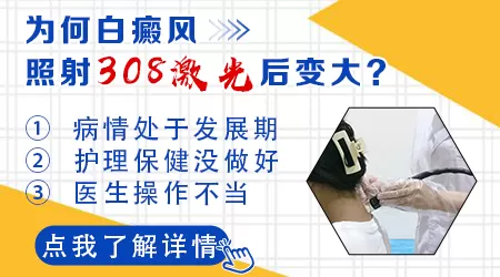 早期白癜风照308激光会变大变白吗