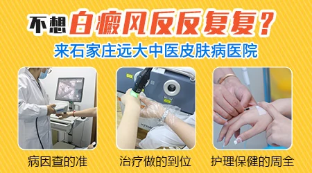 白癜风夏季容易扩散的原因