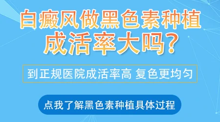 白癜风做黑色素种植成功率大吗