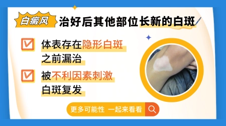 白斑复色后为何又出现新斑