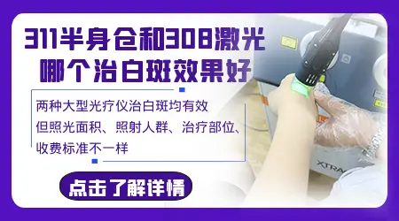 308准分子激光和窄谱UVB哪种更适合白癜风早期