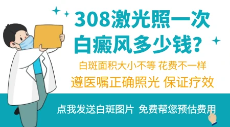 白癜风照一次308激光费用大概多少