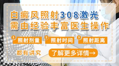 白癜风照一次308激光费用大概多少
