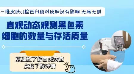 邯郸哪家医院有三维皮肤CT检测