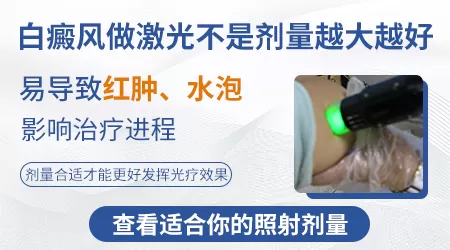 邯郸哪个医院有美国进口308nm准分子激光