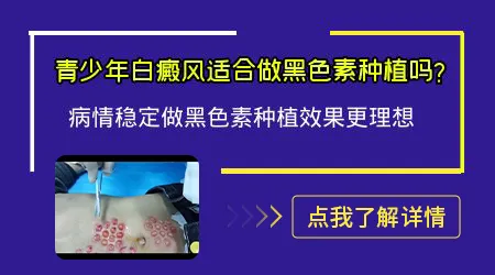 黑色素移植手术适合哪些白癜风