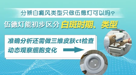 白癜风进展期和稳定期是怎么划分的