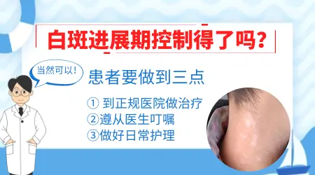 白癜风白斑越来越明显怎么控制