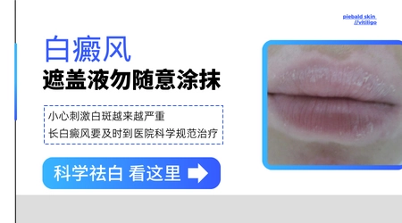 白癜风遮盖液用哪个牌子效果好