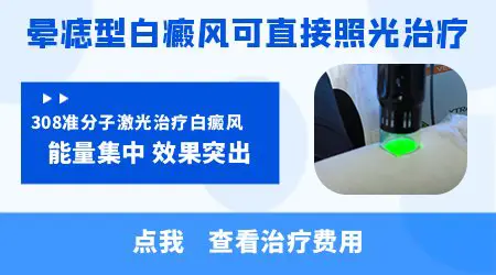 黑痣周边发白祛痣后多久恢复原样