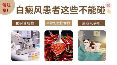 白癜风进入发展期怎么办