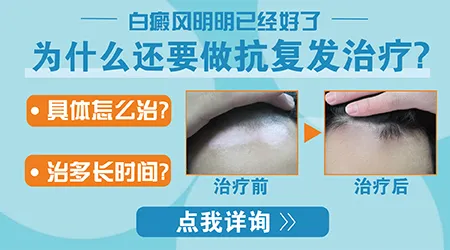 白斑复查需要做和初次检查一样的项目吗