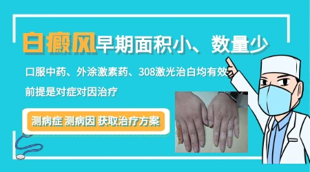 早期白癜风白斑没缩小也没扩散还要治吗