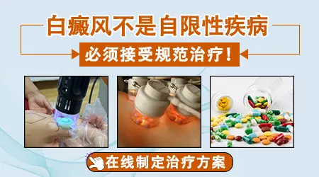 轻微的小白斑不治疗能自己好吗