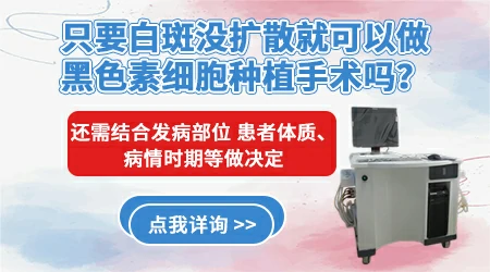 白癜风表皮移植和黑素细胞移植选哪个更好