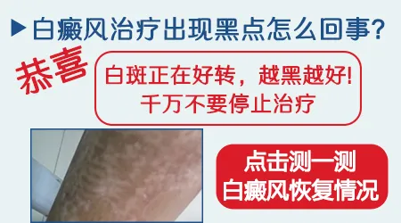 白斑中间长小黑点是不是好转的信号