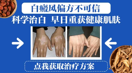 无花果泡酒治白癜风偏方怎么用