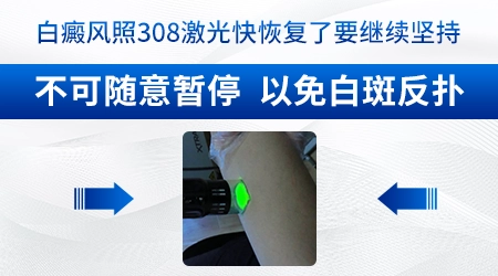 进展期白癜风不能照308激光吗