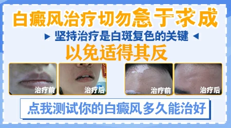 不同部位白癜风治疗难度对比排序