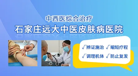 不同部位白癜风治疗难度对比排序