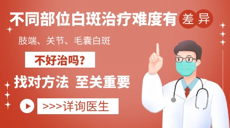 不同部位白癜风治疗难度对比排序