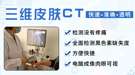 白斑做个皮肤ct大概多少钱