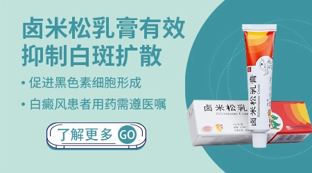卤米松能控制白癜风不扩散吗